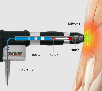 ショックマスターの仕組み